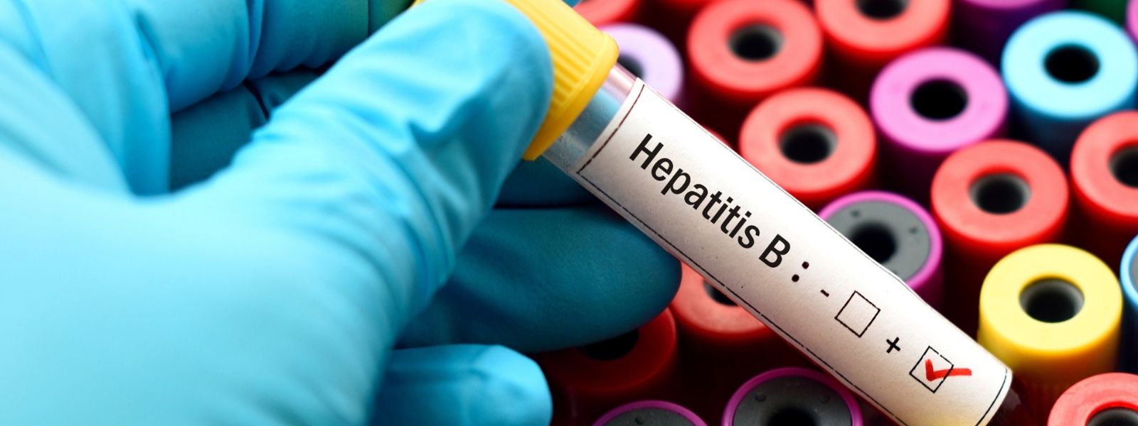 Hepatitis B Screening Rolled Out